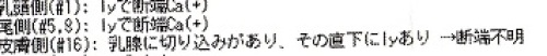 img011断端強陽性.jpg
