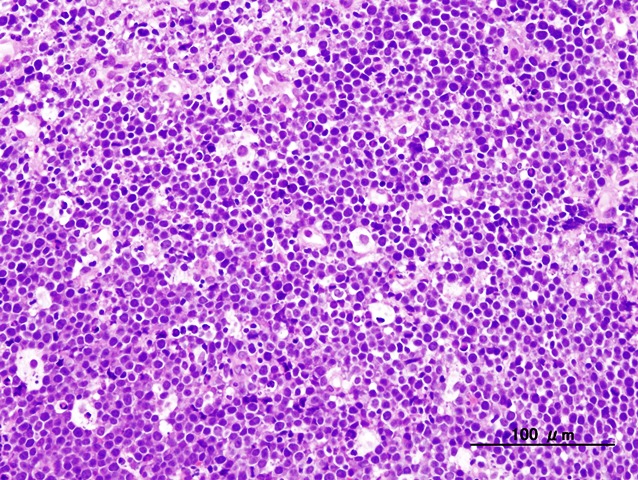 Lymphoglandular Bodies Lgb 病理検査の玉手箱 楽天ブログ