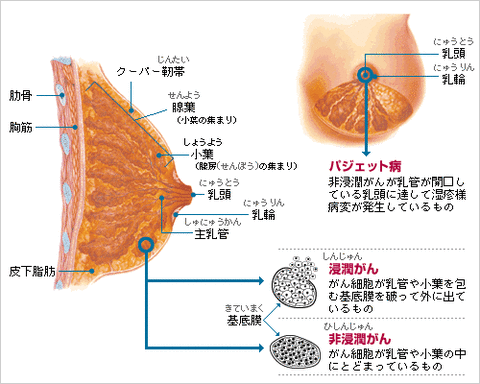 気まぐれオヤジの気まぐれ生活 北斗晶の乳がんステージ2b ブログで病状を激白