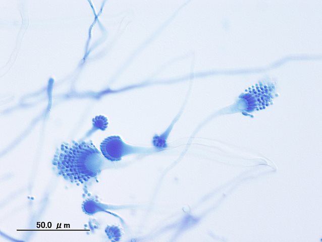 アスペルギルス分生子柄の図