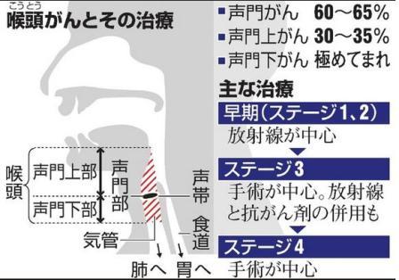 がん情報 喉頭がん 患者を生きる 木久扇の声 ５ 情報編 声がれ 見逃さないで ワルディーの京都案内 楽天ブログ