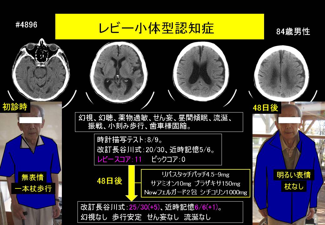 ドクターイワタの認知症ブログ2013年12月27日 | ドクターイワタの認知