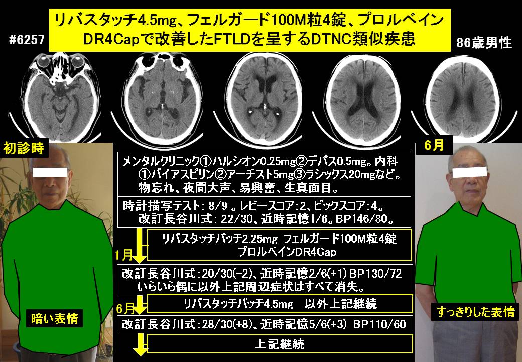 フェルガード100M 粒タイプ *2の+aethiopien-botschaft.de