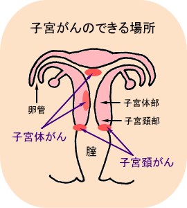 子宮 体 癌 ブログ 50 代