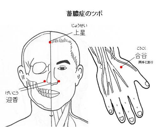 蓄膿症 膿 を 出す ツボ 蓄膿症の治し方はツボと鼻うがいがいい 手術は日帰り