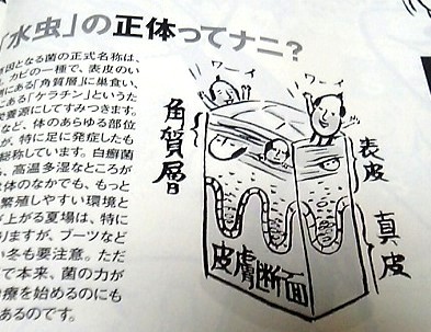 水虫3.JPG