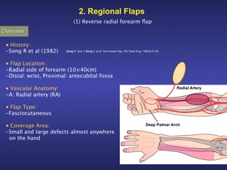 11/01/24 Hand Conference 区域皮弁 形成外科医のアメリカ留学計画 楽天ブログ