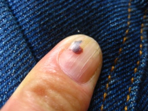 爪の成長 わたしの日記 楽天ブログ