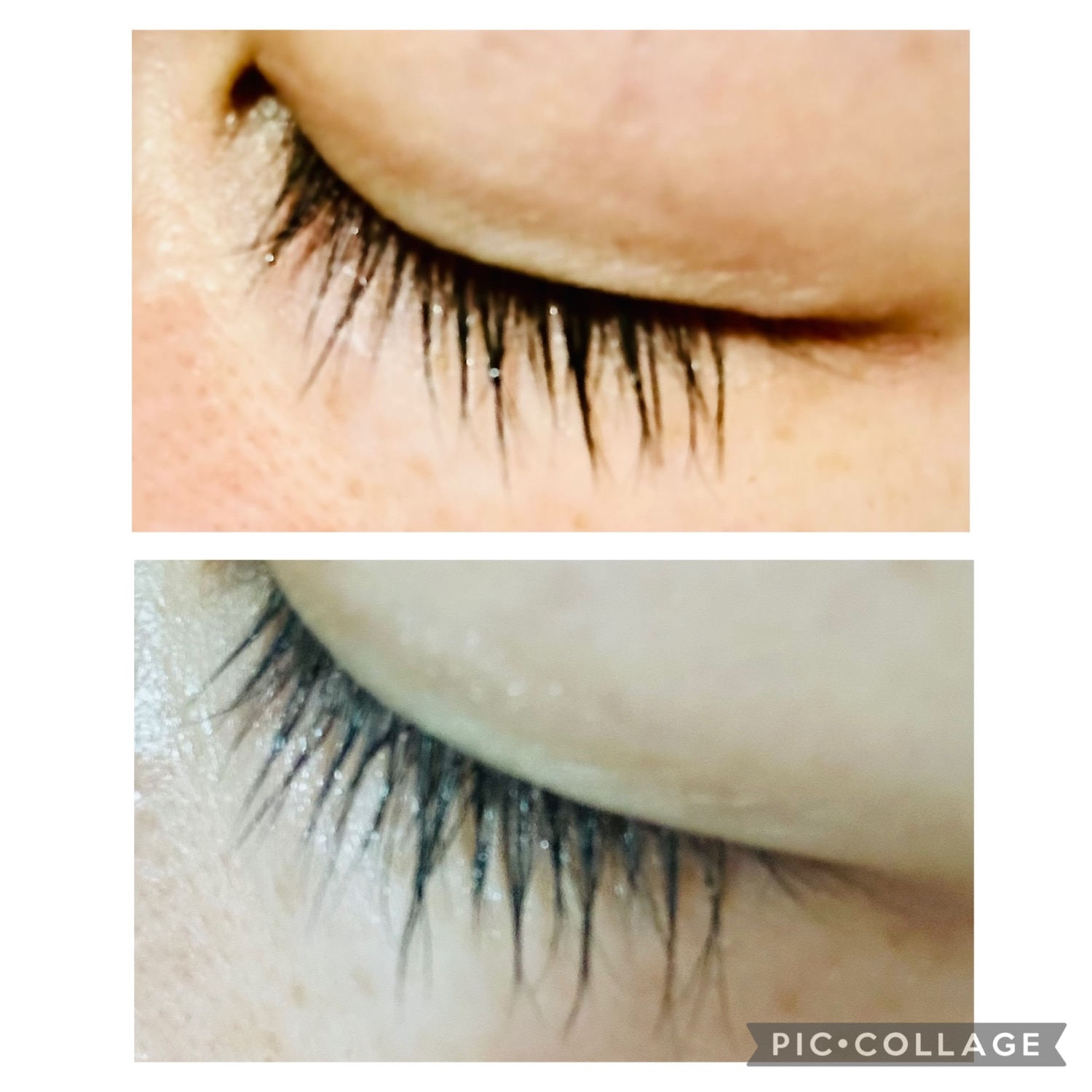 楽天市場】【医師 大注目のヒト幹細胞配合】 まつ毛美容液 まつげ美容