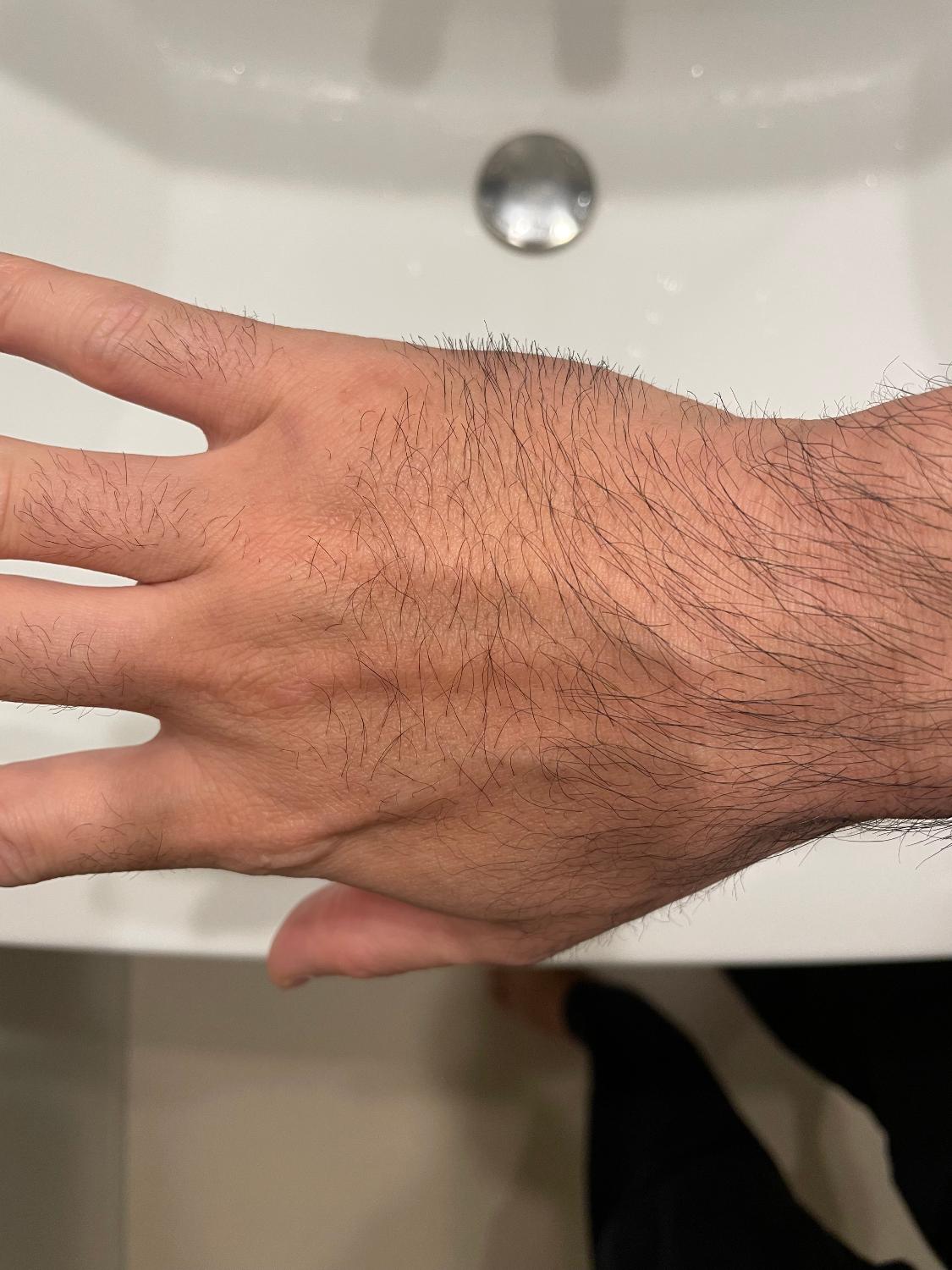 ケノン 脱毛器 口コミ レビュー画像13