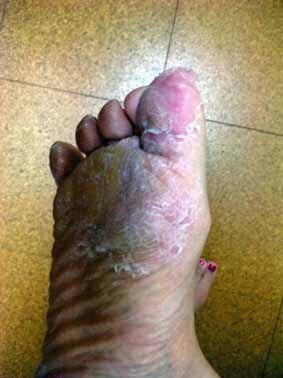 楽天市場 クイックビューティ Qb ベビーフット シトラスキット ベビーフット Baby Foot フットケア 送料無料 クイックビューティ Qb ベビーフット シトラスキット 1セット ベビーフット Baby Foot フットケア 送料無料 Rcp 爽快ドラッグ 未購入を