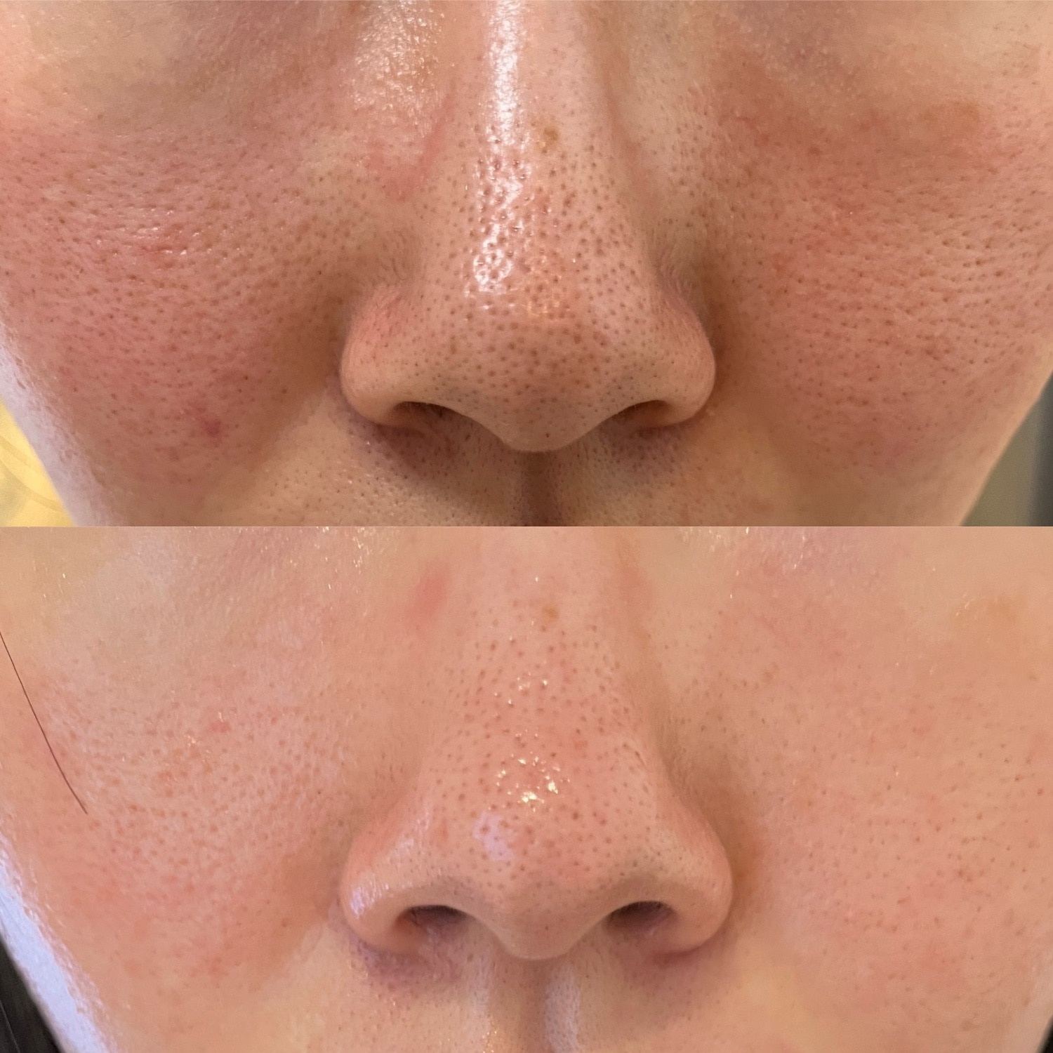 コメントで500円オフ新品未使用 セロラバイ ペンタショット★ブーストセラム×3 楽天市場】☆5000円クーポン+毛穴セラム☆ 楽天1位 美顔器 韓国