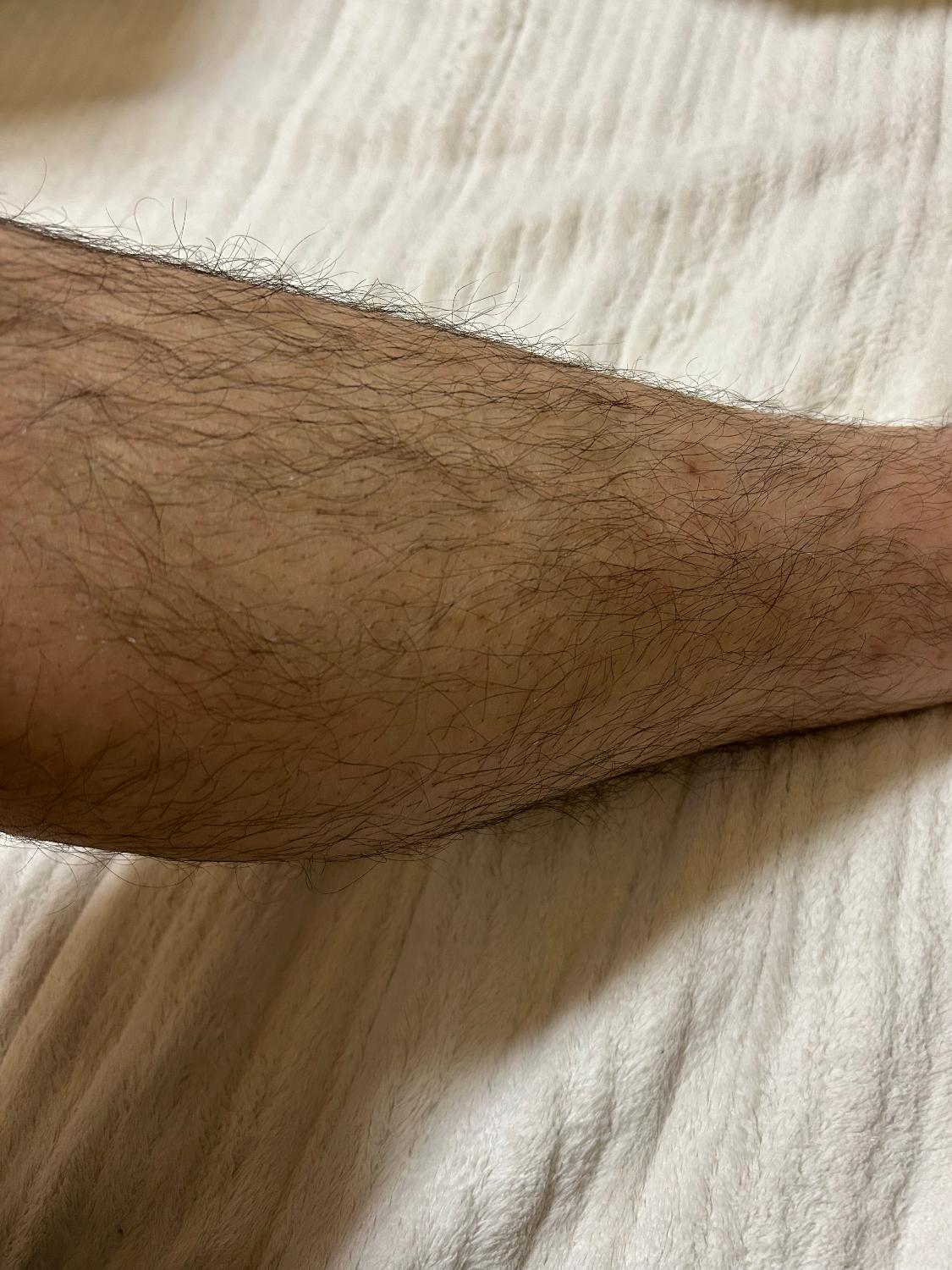 ケノン 脱毛器 口コミ レビュー画像11