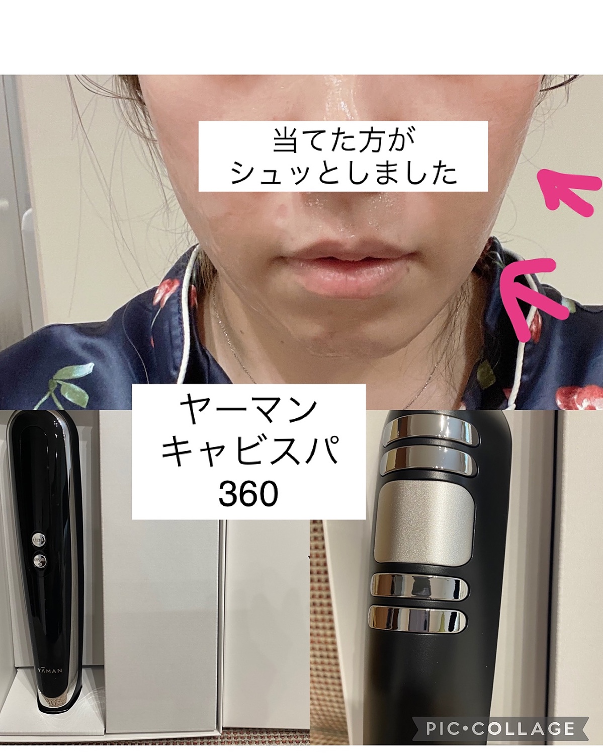 ヤーマン キャビスパ プレステージ for salon サロン専売 - 美容機器