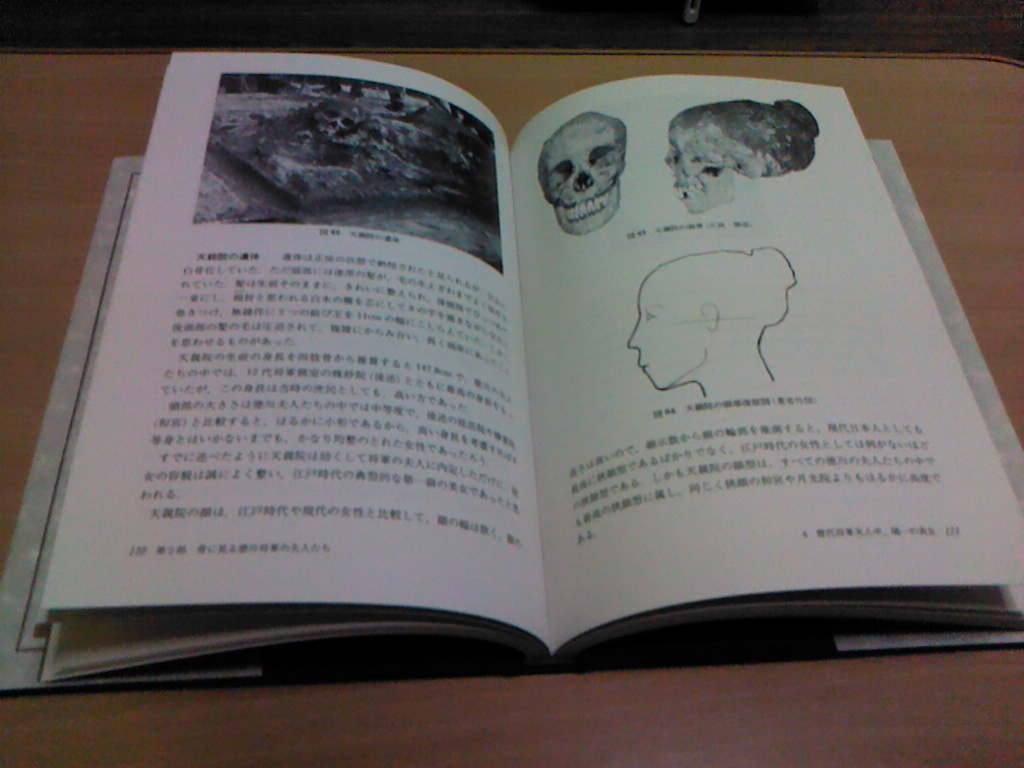 骨は語る 徳川将軍・大名家の人びと - 人文