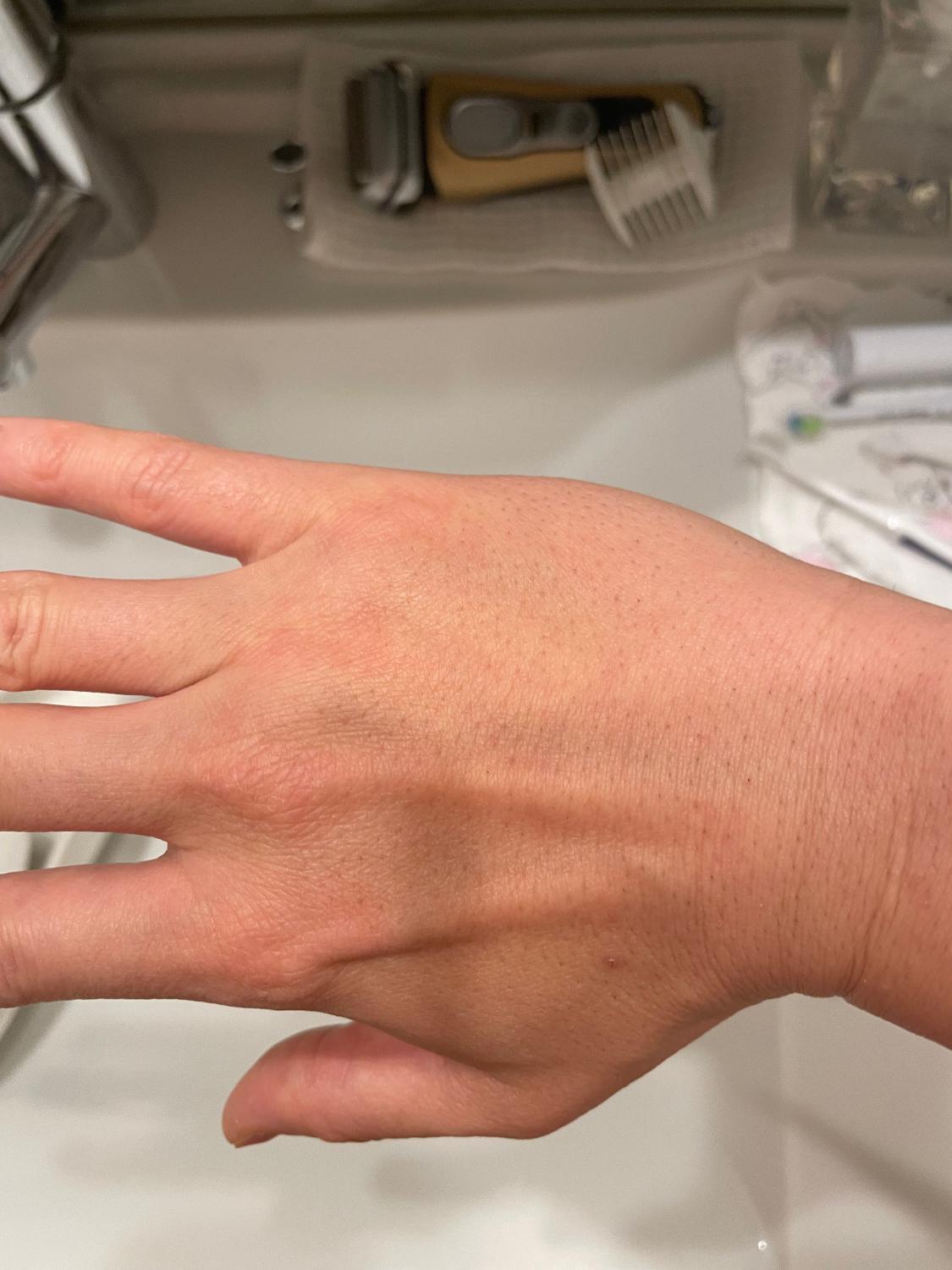 ケノン 脱毛器 口コミ レビュー画像14