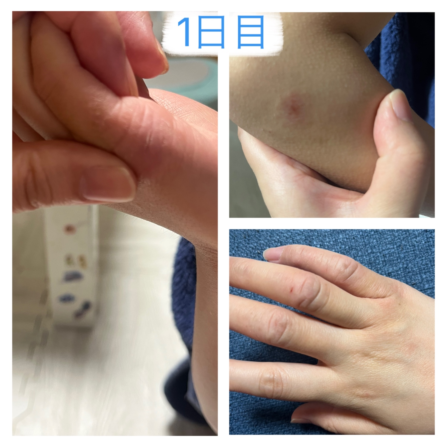 楽天市場】アトピロン ATPLON ベビーソープ 赤ちゃん 敏感肌