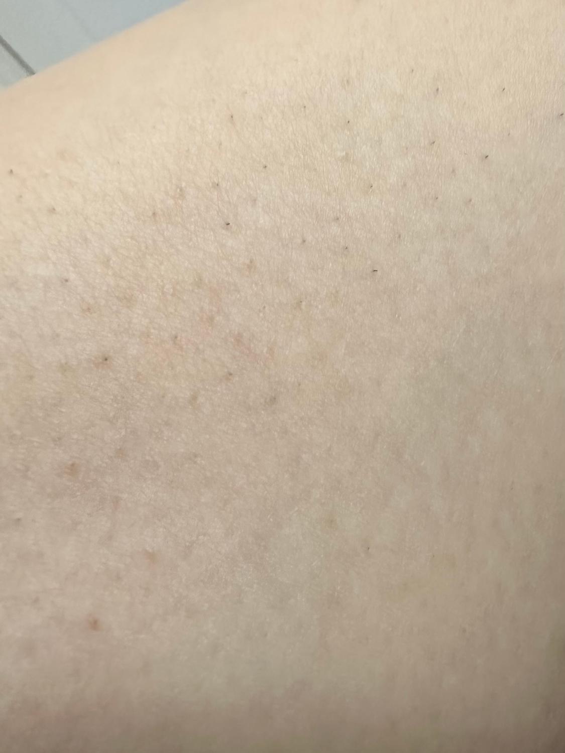 購入者レビュー写真