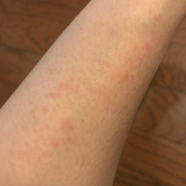 楽天市場 ケノン 公式 脱毛器 ランキング3347日1位 レビュ 15万件 最新バージョン 美顔器 フラッシュ 家庭用 ムダ毛 ヒゲ ボディ メンズ Kenon 永久に剃刀は嫌口コミ アンダーヘア レーザー 髭 フェイス 光美容器 脱毛器ケノン公式 脱毛機 Vioひげ 顔 光脱毛器 詳細はペ