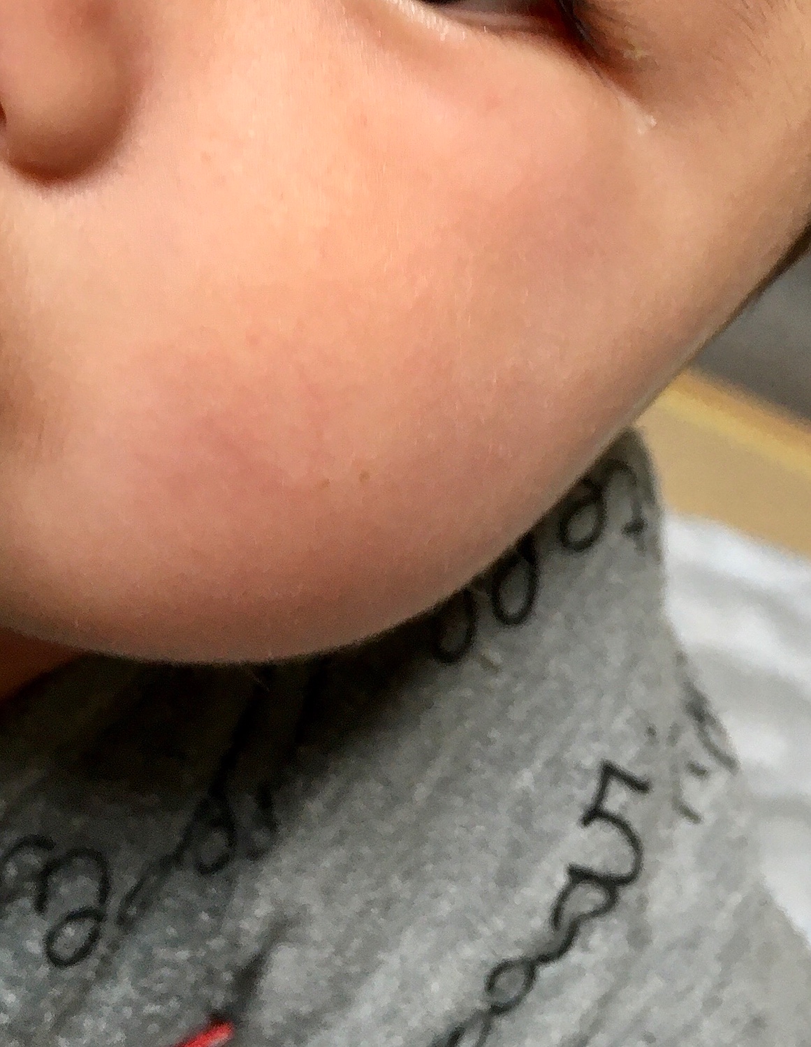 楽天市場 公式 日本でただひとつ 赤ちゃんの肌トラブルにはコレ 1本で保湿 保護 バリア スキンケア ファムズベビー Fam S Baby 出産祝い 誕生日 プレゼント 新生児 人気 好評 高評価 評判 歳 ヶ月 Fams 乾燥肌 アトピー 乳児湿疹 トラブル 敏感肌 保湿
