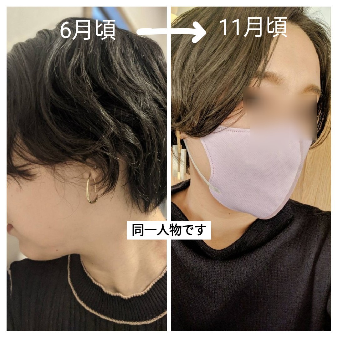 イッシヘアパックセラム24 - トリートメント