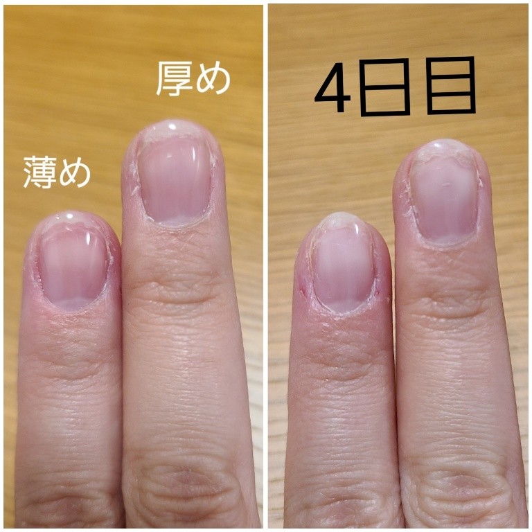 楽天市場 ピールオフ ベースジェル ペロリン ベースに塗ってジェルネイルをするだけで剥がせる ジェルネイル はがせる クリアジェル ネイル ベースジェル トップジェル ワンステップジェル ジェル ベース クリアネイル ジェルネイル トップ クリア ネイルジェル 楽天市場 ピールオフ ベースジェル ペロリン ベースに塗ってジェルネイルをするだけで剥がせる ジェルネイル はがせる クリアジェル ネイル ベースジェル トップジェル ワンステップジェル ジェル ベース クリアネイル ジェルネイル トップ クリア ネイルジェル