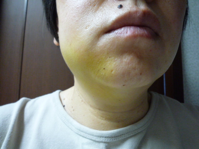 P1010563.JPG