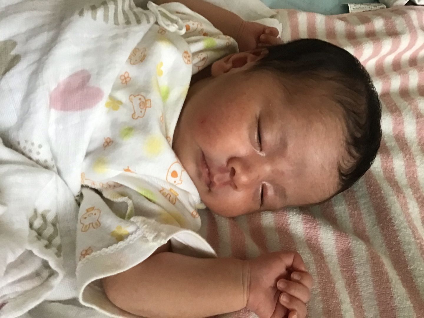 赤ちゃん 1 ヶ月 検診