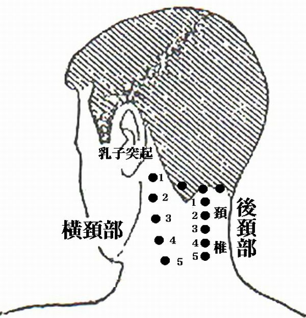 横頚部・後頚部