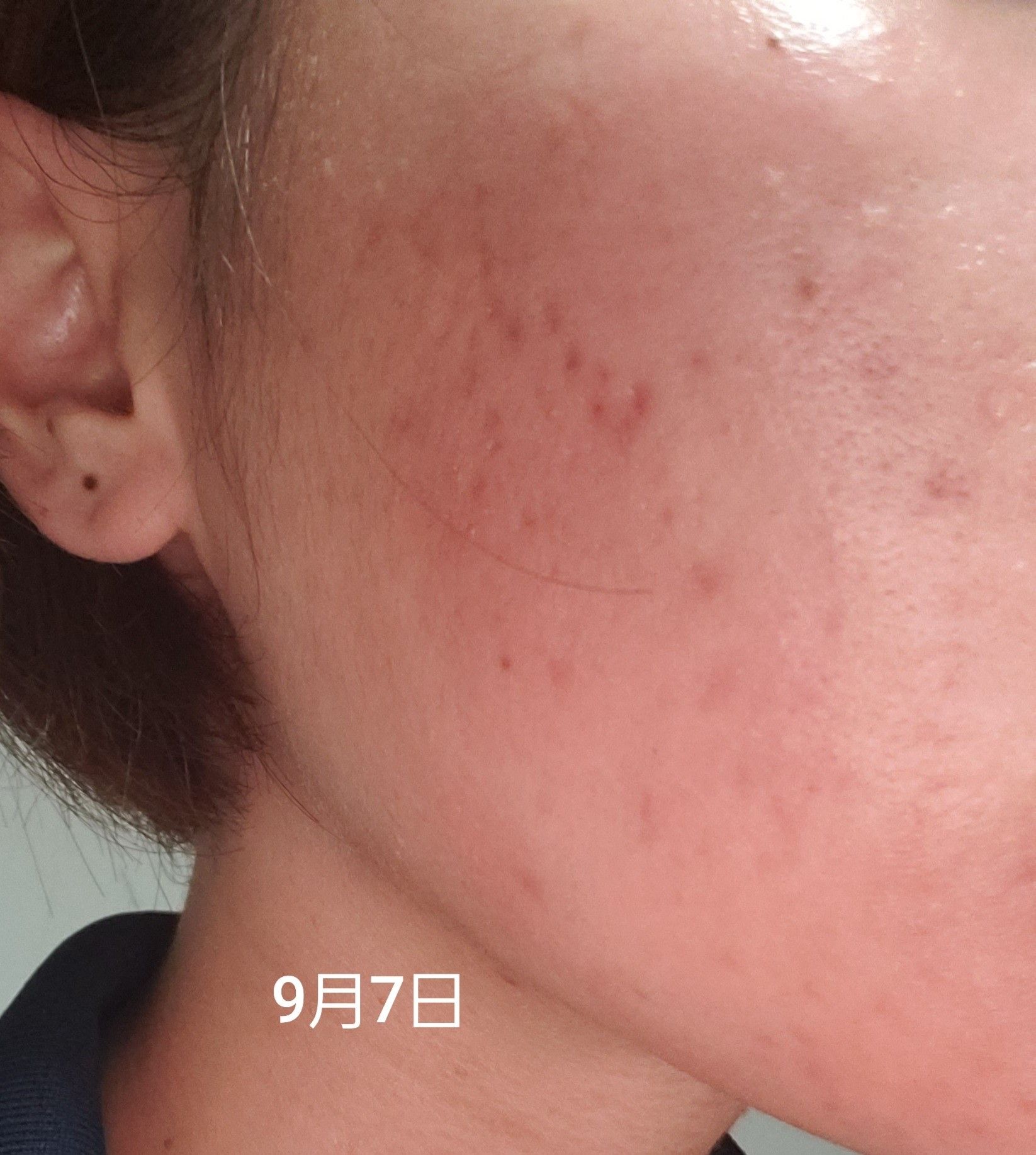 赤くなる ただの日記だよ 楽天ブログ