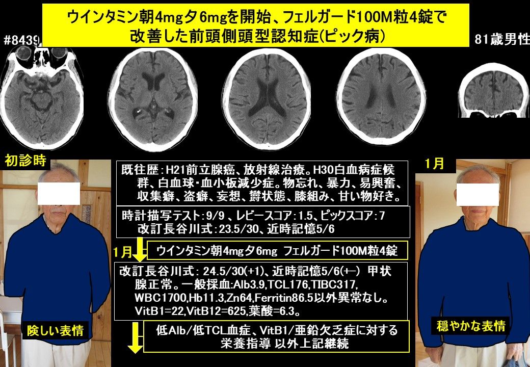 2ページ目の記事一覧 ドクターイワタの認知症 発達障害ブログ 認知症専門外来と認知症専門往診を融合 楽天ブログ