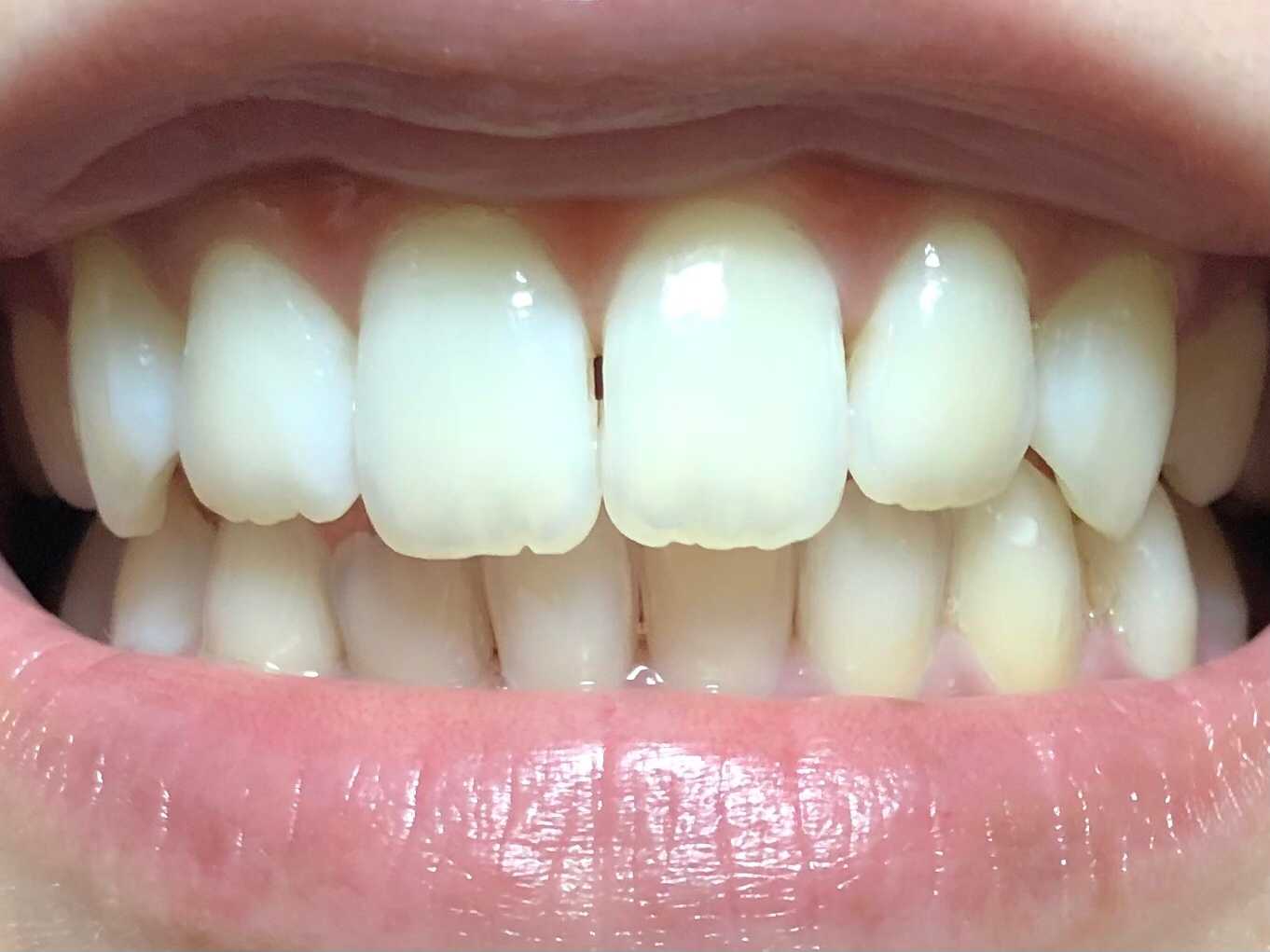 カテゴリ未分類 いい歯日記 楽天ブログ