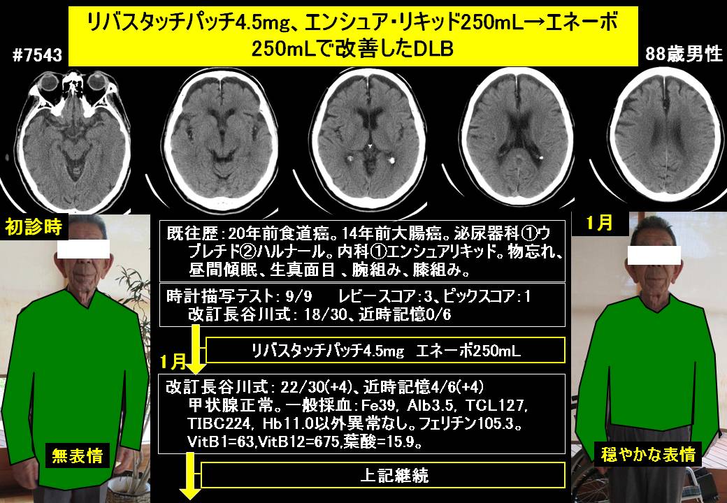 5ページ目の記事一覧 ドクターイワタの認知症 発達障害ブログ 認知症専門外来と認知症専門往診を融合 楽天ブログ