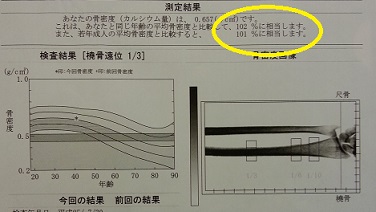 骨粗しょう症