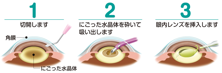 20150213-2.jpg