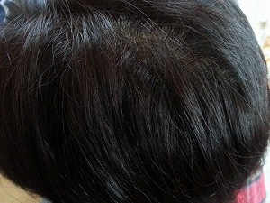 ブローネ