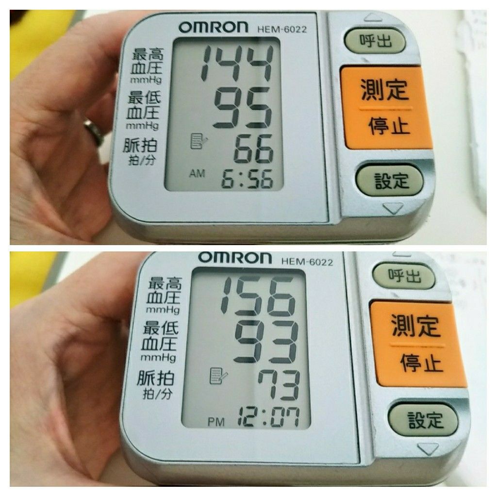 血圧 正常 値 70 代