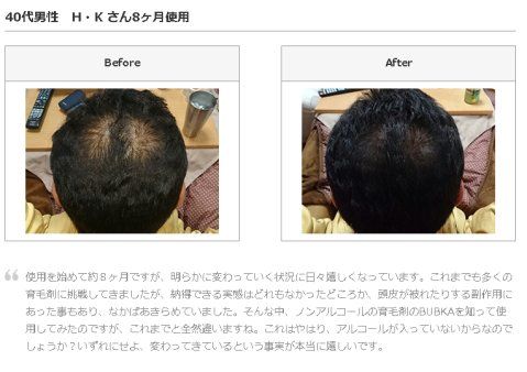 Bubkaの育毛効果 実践1ヶ月目と3ヶ月目の効果 Bubkaの口コミと育毛効果まとめ 楽天ブログ