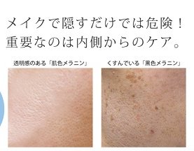 くすみ.jpg