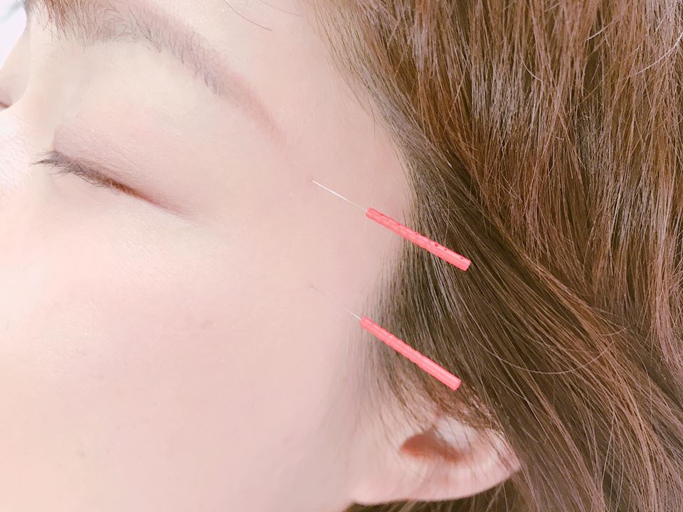 会津 美顔鍼