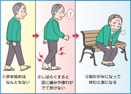 メチコバール メコバラミン は副作用の少ないお薬です 本当の美しさを求めてーかぐや治療院 楽天ブログ