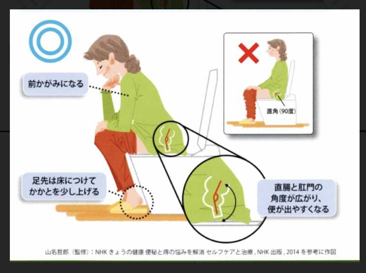 排便中にいきむ危険性