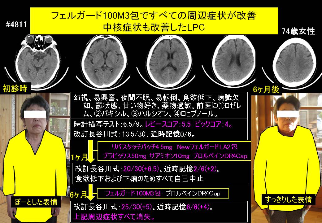 201400620@4811@158