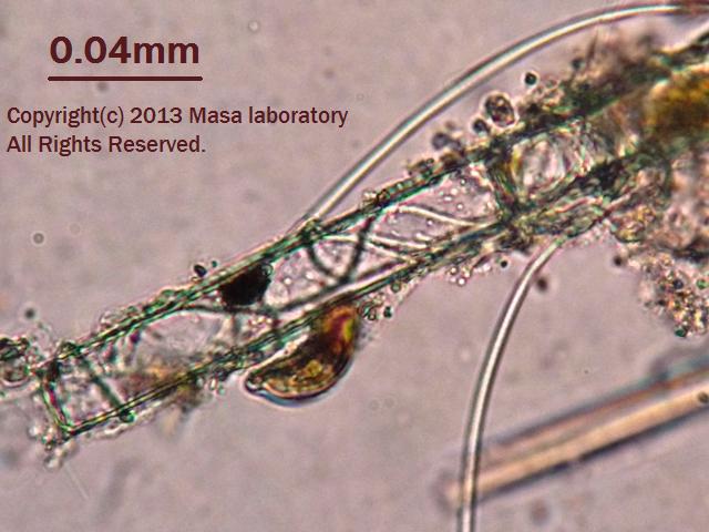 抜け殻に取りつくケイソウ