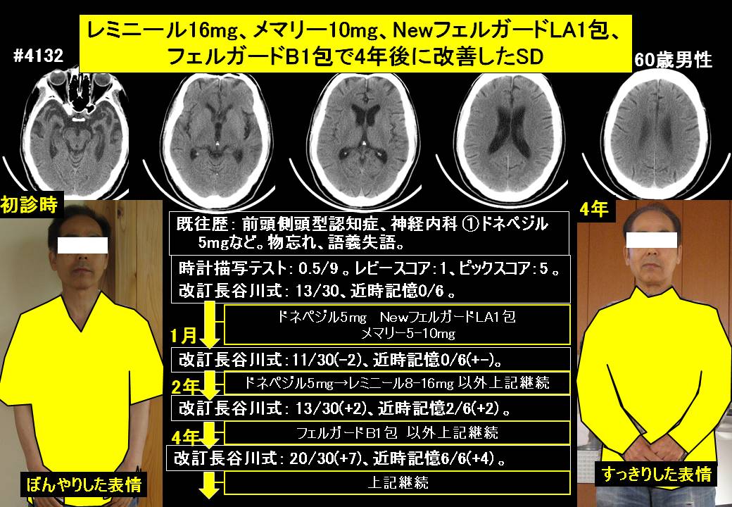 20161211@4132@842