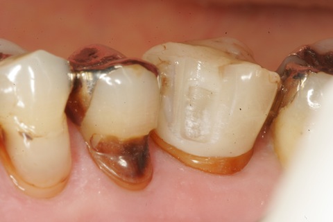 _MG_0022 のコピー.JPG