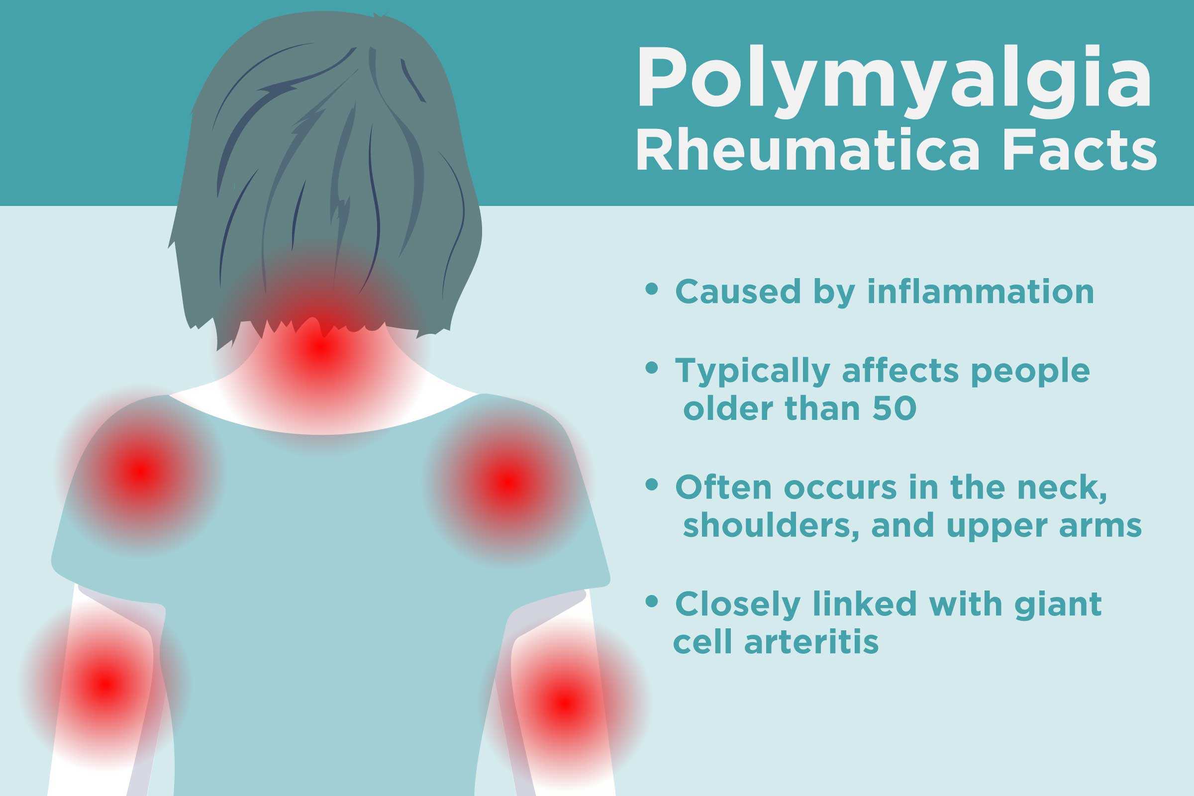 Decoding Polymyalgia Rheumatica: From Diagnosis to Market Trends ...