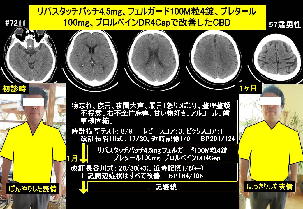 フェルガード100M 粒タイプ *2の+aethiopien-botschaft.de