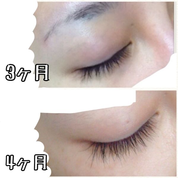 美容のこと いっつきんぐだむ 楽天ブログ