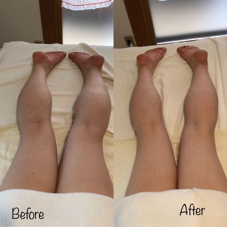 rblog-20180802172152-01.jpg